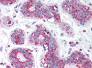 AP07360PU-N - TBC1D1