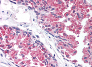 AP07360PU-N - TBC1D1