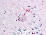 AP07370PU-N - Otoferlin