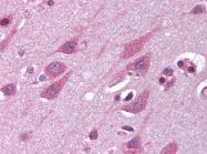 AP07373PU-N - TMED10 / TMP21