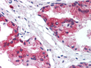 AP07373PU-N - TMED10 / TMP21
