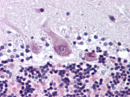 AP07381PU-N - ARHGEF10