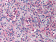 AP07388PU-N - XAF1