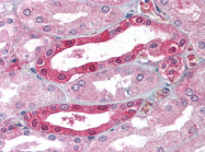AP07391PU-N - Carbonic anhydrase 2