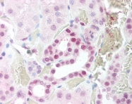 AP07412PU-N - IKKA
