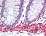 AP07427PU-N - MYOD1