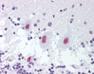 AP07439PU-N - Retinoblastoma-associated protein / RB1
