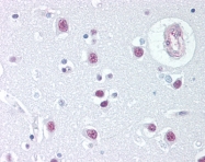 AP07439PU-N - Retinoblastoma-associated protein / RB1