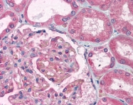 AP07456PU-N - TTRAP