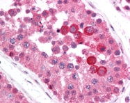 AP07458PU-N - B-Raf proto-oncogene