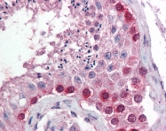 AP07575SU-N - Cullin-4A