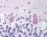 AP07574PU-N - Huntingtin