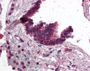 AP07559PU-N - AP3 complex subunit delta-1 / AP3D1