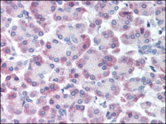 AP06939PU-N - GPRC5C / RAIG3