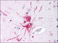 AP06959PU-N - GPR52