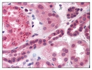AP07705PU-N - EDG3 / S1P3