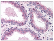 AP07706PU-N - EDG4 / LPAR2