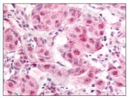 AP07709PU-N - E2F1