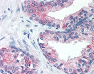 AP07545PU-N - ATF3