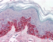 AP07544SU-N - APC2 / ANAPC2