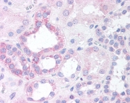 AP07536PU-N - NOXO1