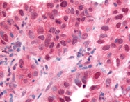 AP07534PU-N - EGR1
