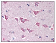 AP07715PU-N - NLRC4