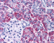AP07509PU-N - NOXA
