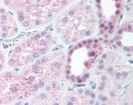 AP07500PU-N - MAP2K4