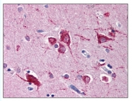 AP07726PU-N - RHEB