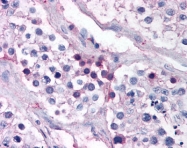 AP07481PU-N - Aurora kinase A