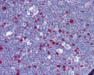 AP07469PU-N - Nucleophosmin