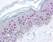 AP07468PU-N - Nucleophosmin