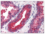 AP07747PU-N - EIF2AK2 / PKR