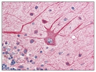 AP07747PU-N - EIF2AK2 / PKR
