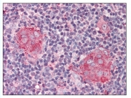AP07757PU-N - Interleukin-21 receptor / IL21R