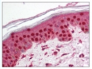 AP07784PU-N - TEP1 / TLP1