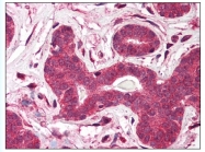 AP07784PU-N - TEP1 / TLP1