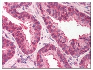 AP07791PU-N - TMED10 / TMP21