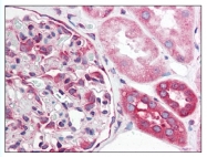 AP07792PU-N - CD261 / TRAILR1