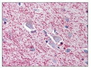 AP07798PU-N - TRIM5 / RNF88