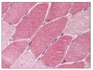 AP07800PU-N - TSC1 / Hamartin
