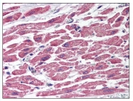 AP07800PU-N - TSC1 / Hamartin