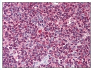 AP07802PU-N - TSLP