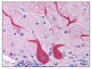 AP07814PU-N - CD290 / TLR10