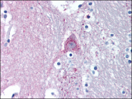 TA341195 - MARK1