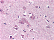 TA341196 - MARK1
