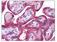 AP07820PU-N - EGFR / ERBB1