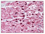 AP07824PU-N - PPAR-gamma