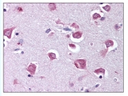 AP07825SU-N - RELA / NF-kB p65